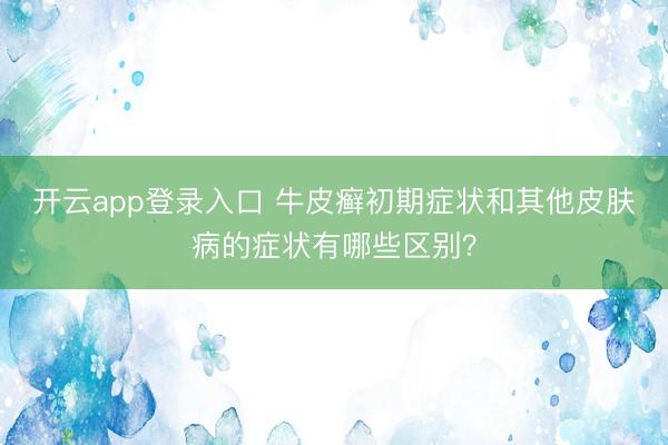 开云app登录入口 牛皮癣初期症状和其他皮肤病的症状有哪些区别？